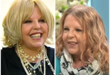 Sally Thomsett Face Illness