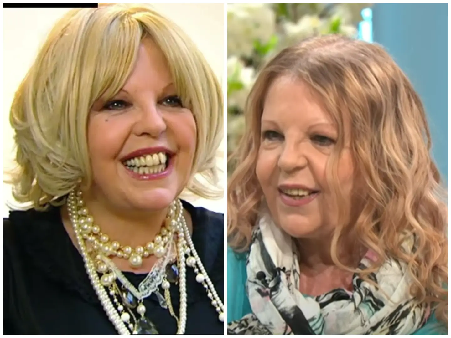 Sally Thomsett Face Illness Facts Rumors And The Truth Behind The Sally Thomsett Face Illness Facts Rumors And The Truth Behind The